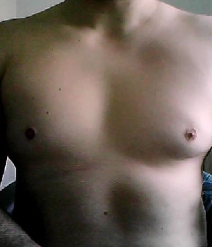 Achilles79