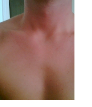 hotday