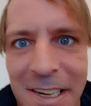 Allandyx