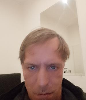 Allandyx