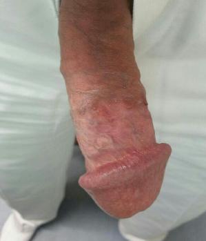 Sex Inserat von: John666