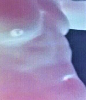 Llover