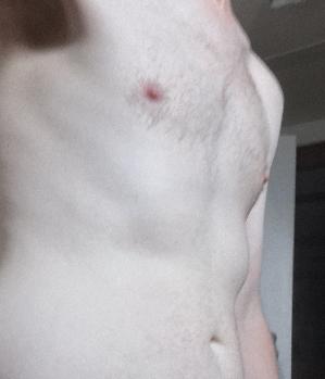 oral92